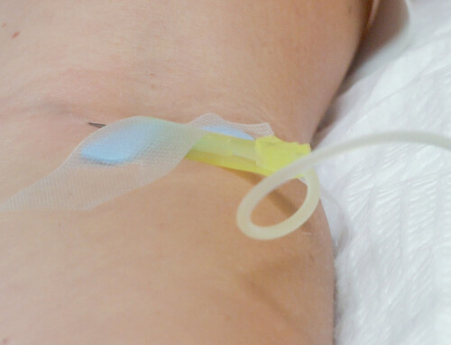 Enhancing Your IV Infusion Therapy With an Oxygen Bar